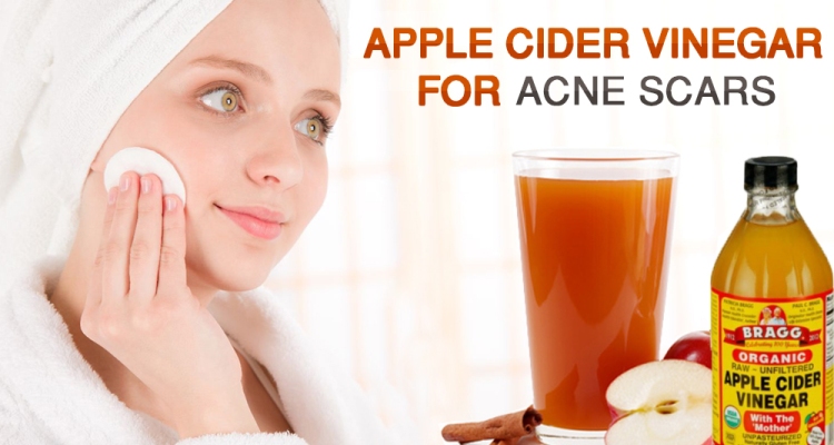 6 Steps to Include when Using Green Apple to Remove Scars