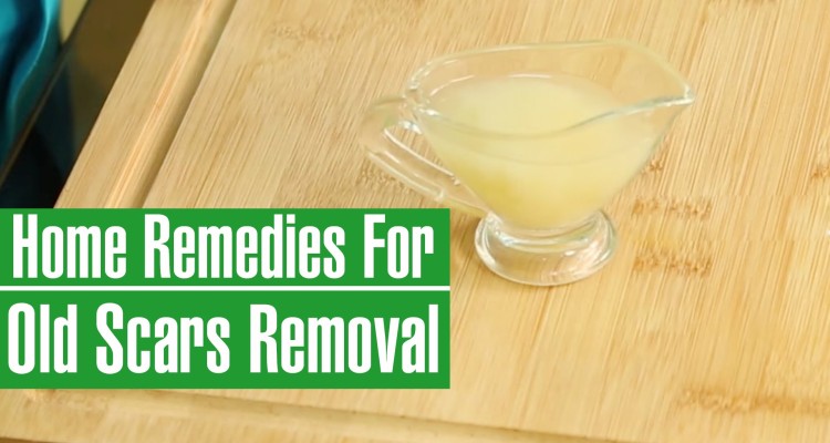 9 Treatments To Be Used When Removing White Scars