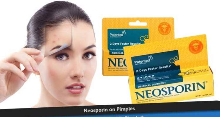 Neosporin Acne – How Well Does It Work For Acne Scars?